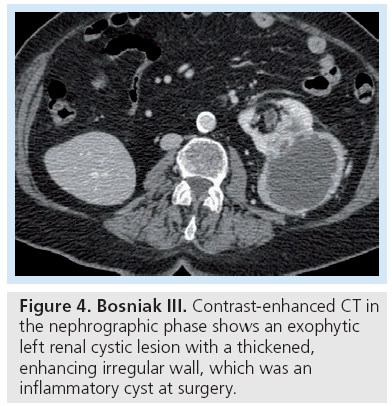 imaging-in-medicine-nephrographic-phase