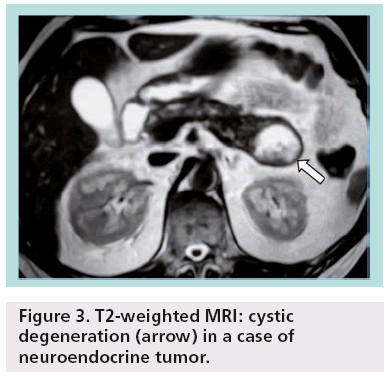 imaging-in-medicine-neuroendocrine