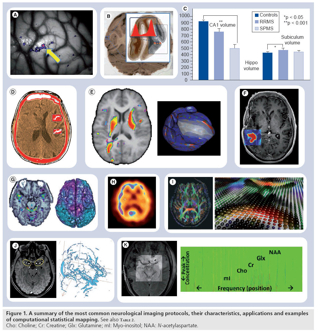 imaging-in-medicine-neurological-imaging