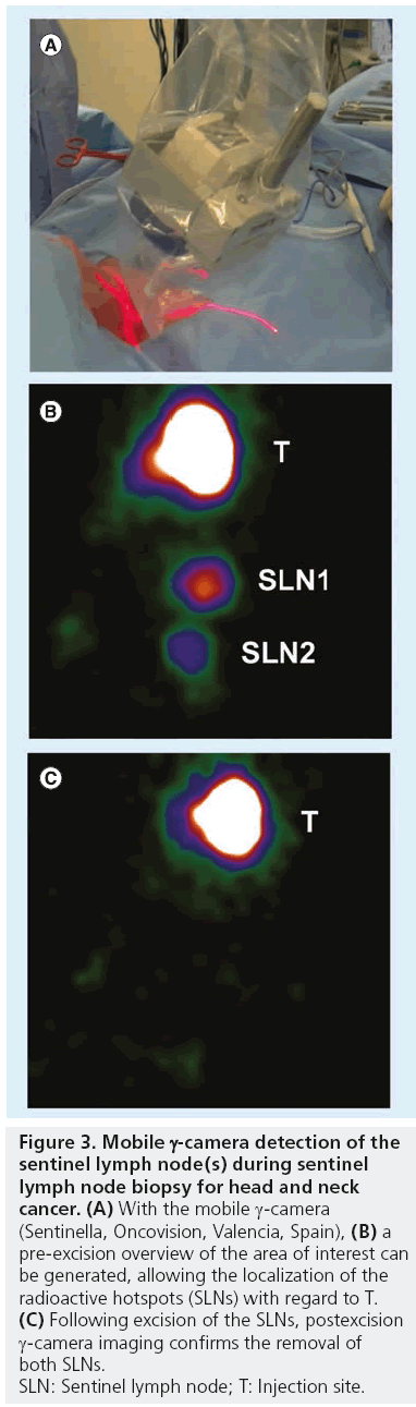 imaging-in-medicine-node-biopsy