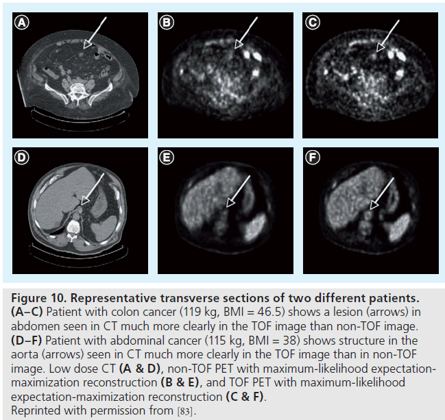 imaging-in-medicine-non-TOF