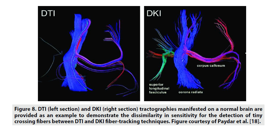 imaging-in-medicine-normal-brain