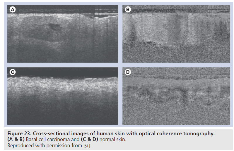 imaging-in-medicine-normal-skin