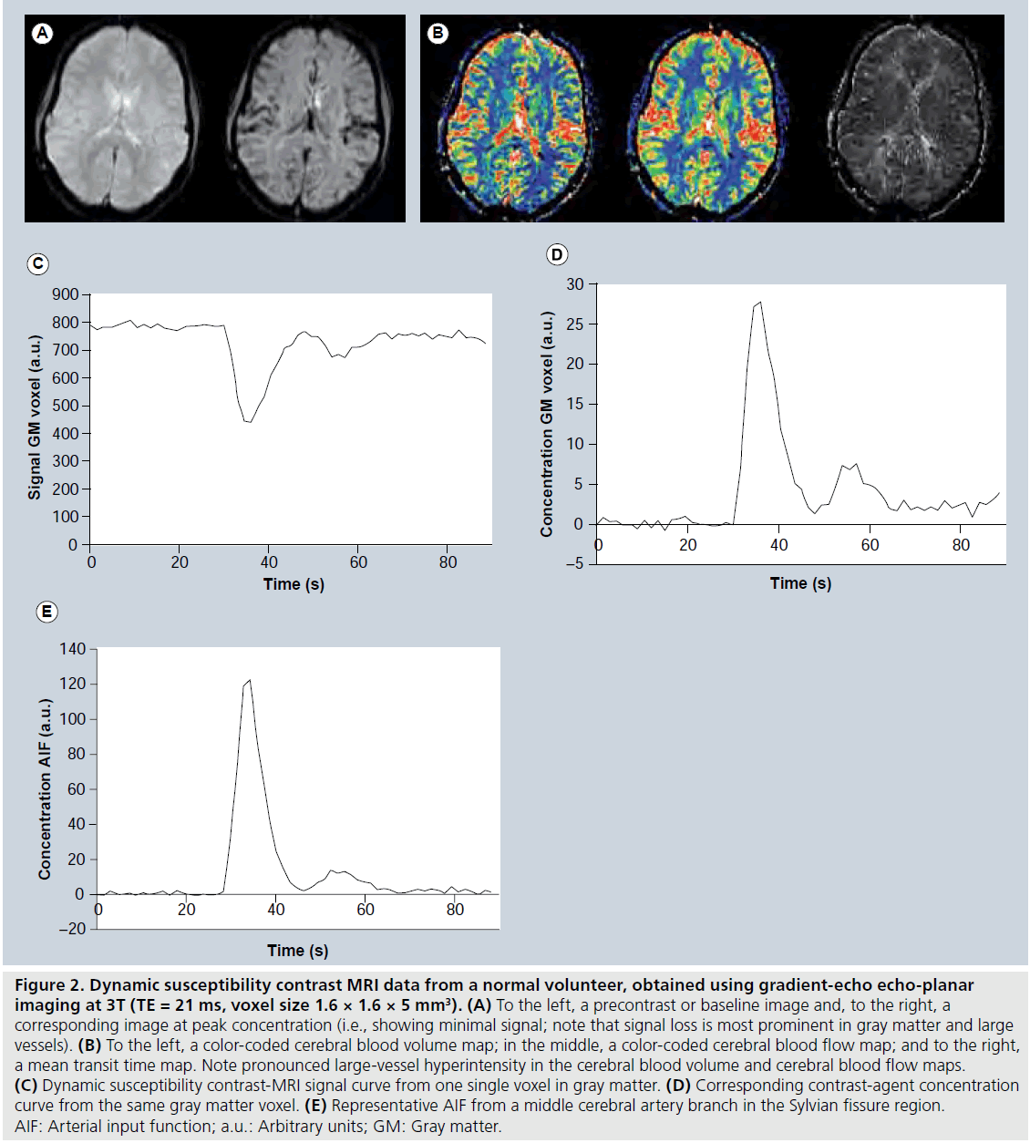 imaging-in-medicine-normal-volunteer