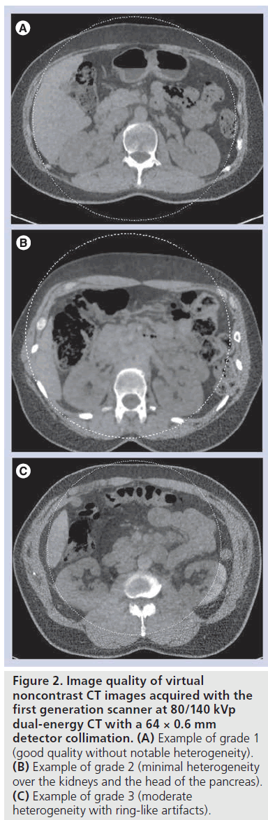 imaging-in-medicine-notable-heterogeneity