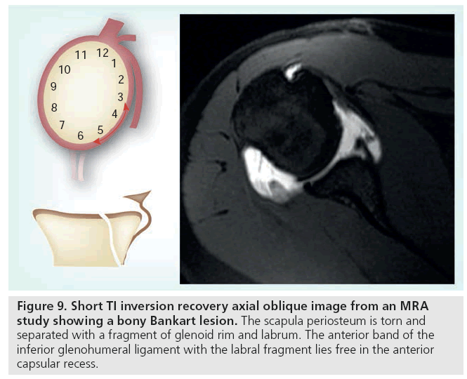 imaging-in-medicine-oblique-image