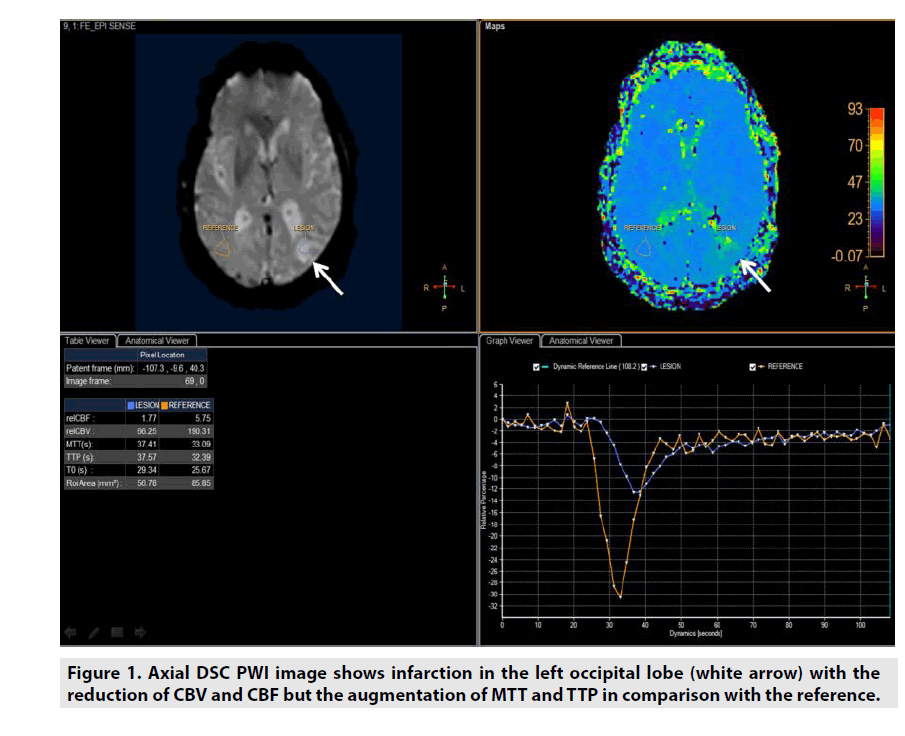 imaging-in-medicine-occipital-lobe