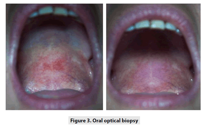 imaging-in-medicine-optical-biopsy