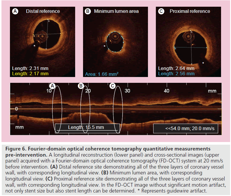 imaging-in-medicine-optical-coherence