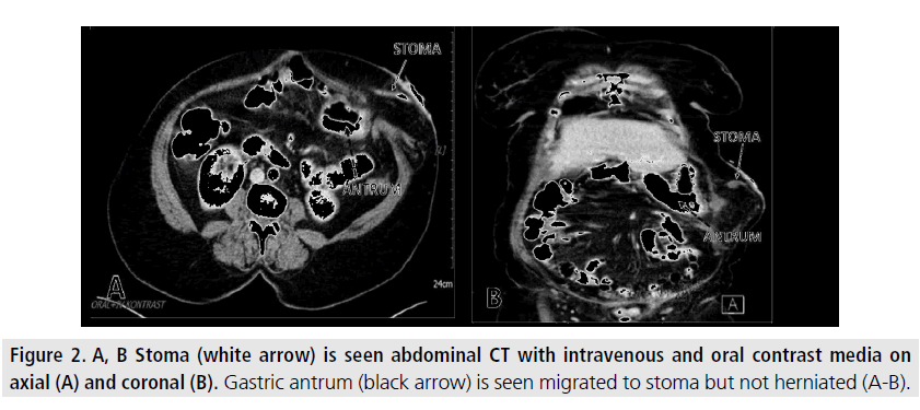 imaging-in-medicine-oral-contrast