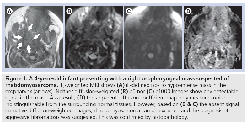 imaging-in-medicine-oropharyngeal