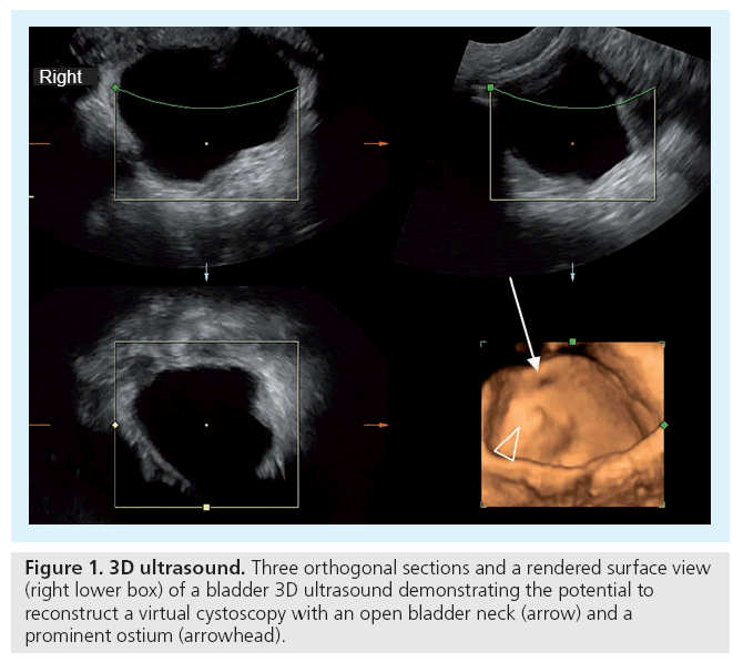 imaging-in-medicine-orthogonal-sections