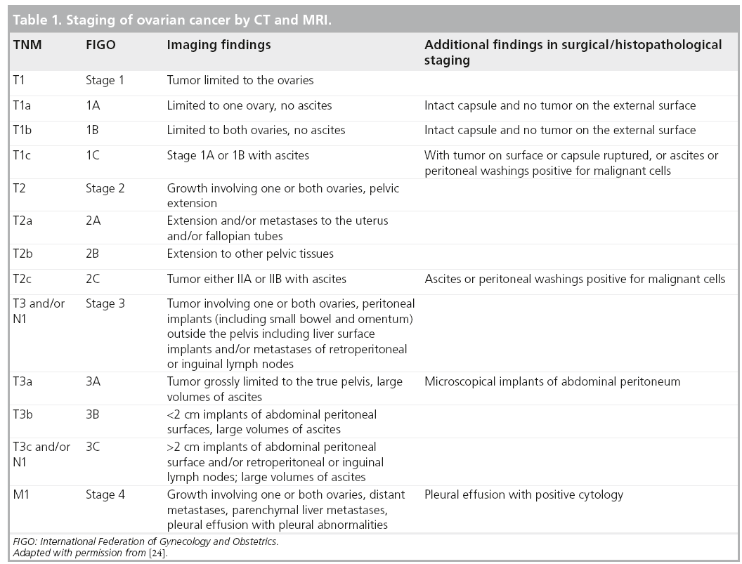 table