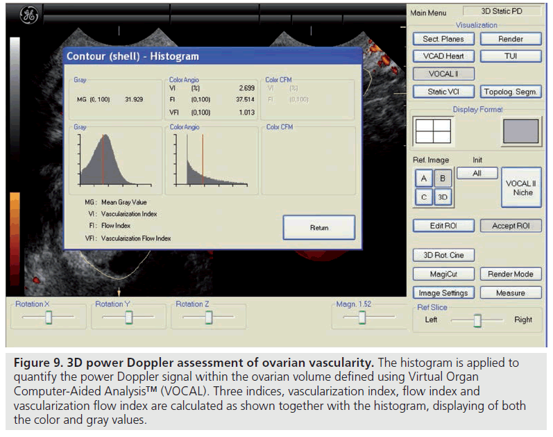 imaging-in-medicine-ovarian-vascularity