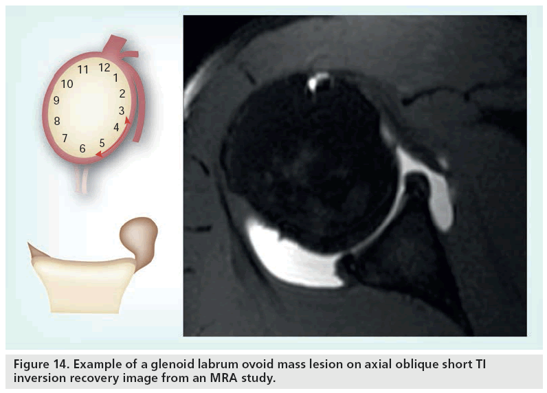 imaging-in-medicine-ovoid-mass
