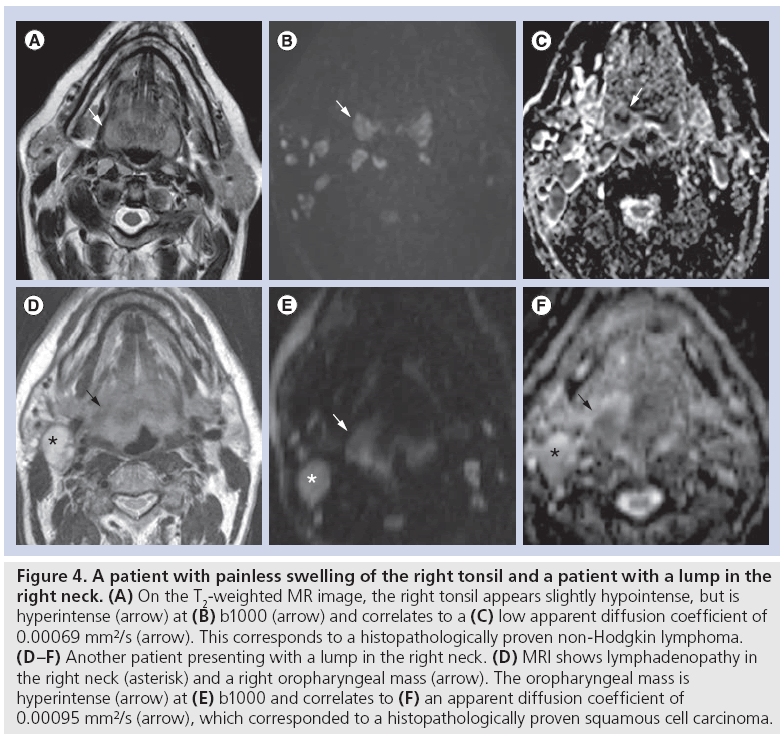 imaging-in-medicine-painless-swelling