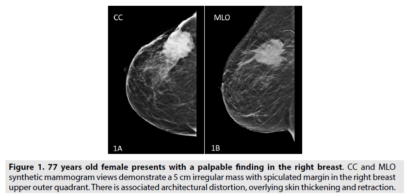 imaging-in-medicine-palpable-finding