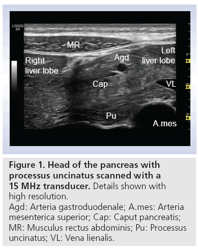 imaging-in-medicine-pancreas