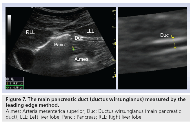 imaging-in-medicine-pancreatic-duct