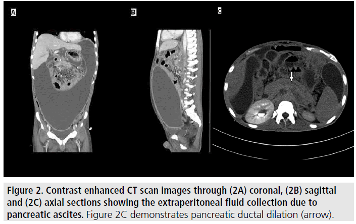 imaging-in-medicine-pancreatic-ductal