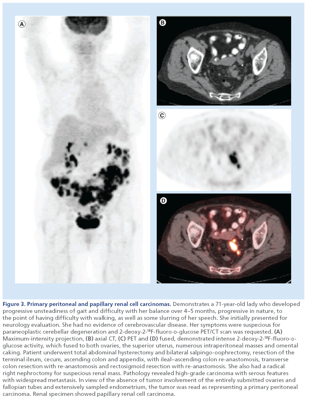 imaging-in-medicine-papillary-renal