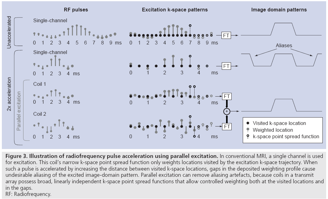 imaging-in-medicine-parallel-excitation