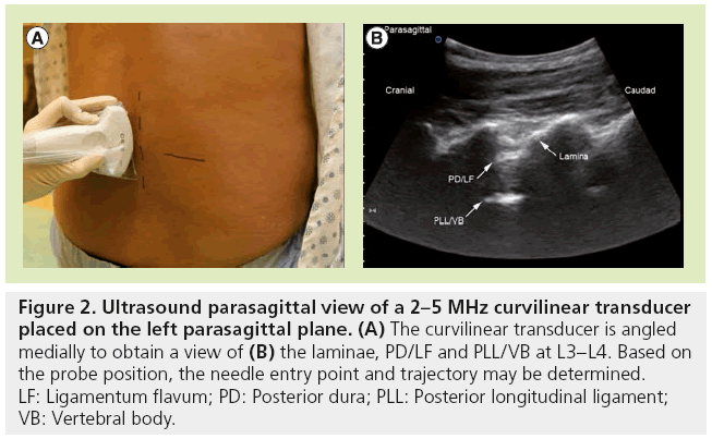 imaging-in-medicine-parasagittal-plane