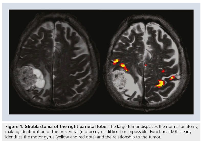 imaging-in-medicine-parietal-lobe