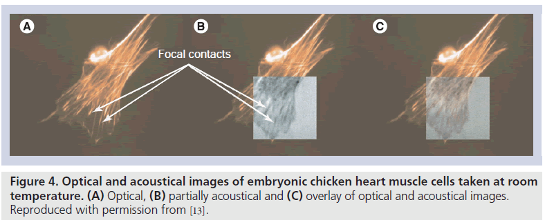 imaging-in-medicine-partially-acoustical