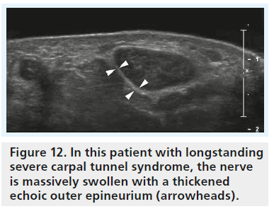 imaging-in-medicine-patient-longstanding