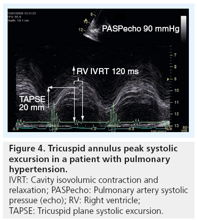 imaging-in-medicine-peak-systolic