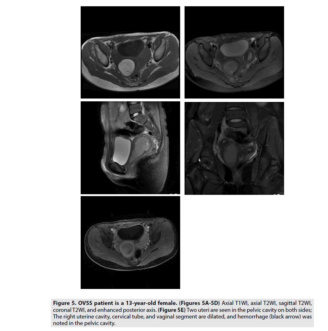 imaging-in-medicine-pelvic-cavity