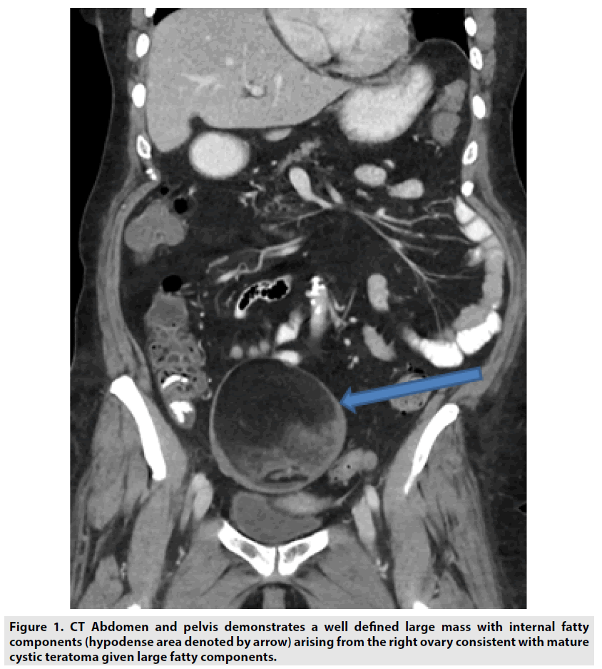imaging-in-medicine-pelvis-demonstrates