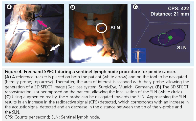 imaging-in-medicine-penile-cancer