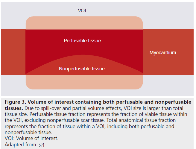 imaging-in-medicine-perfusable-nonperfusable