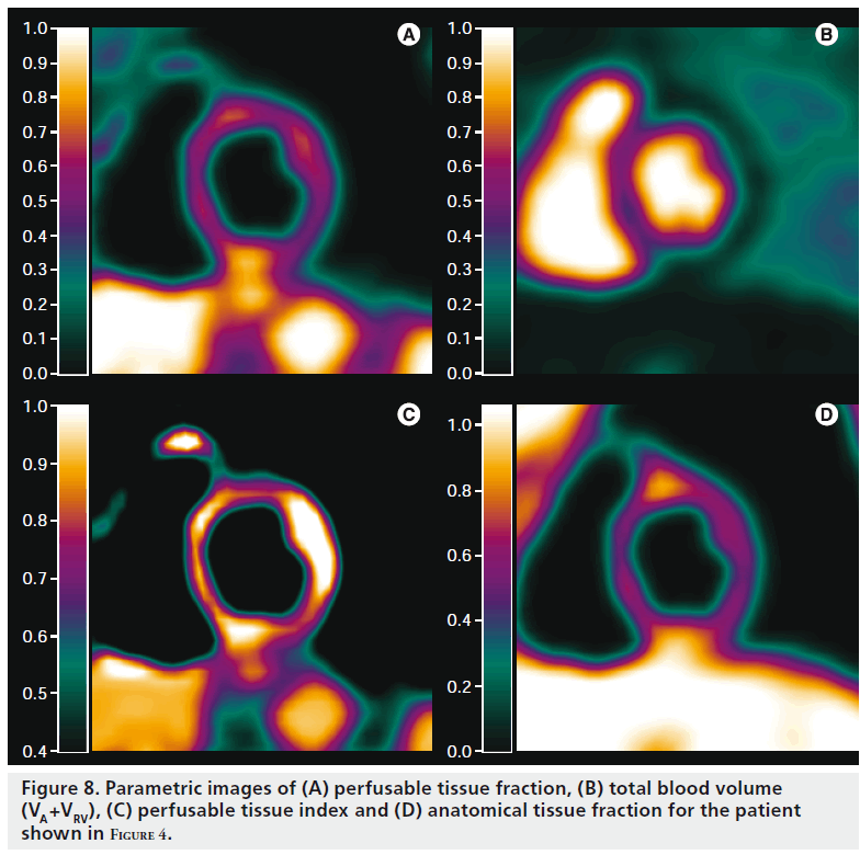imaging-in-medicine-perfusable-tissue