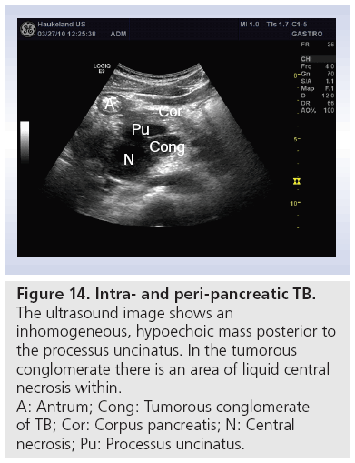 imaging-in-medicine-peri-pancreatic