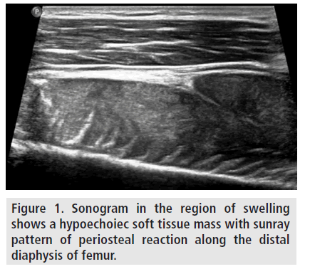 imaging-in-medicine-periosteal-reaction