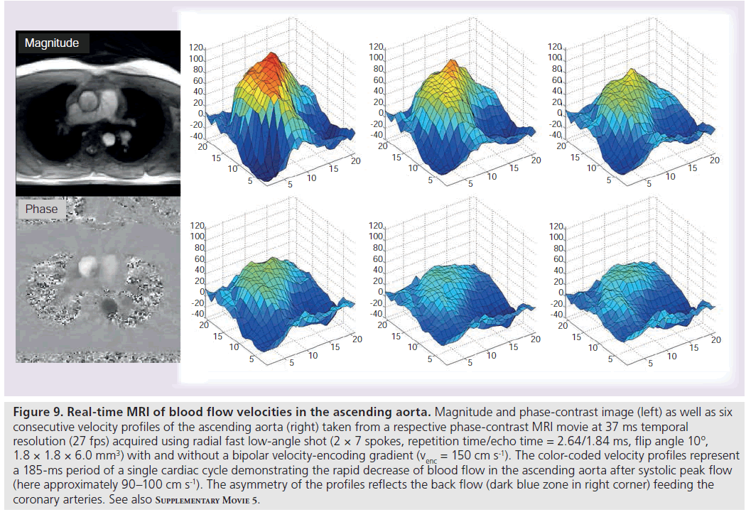 imaging-in-medicine-phase-contrast