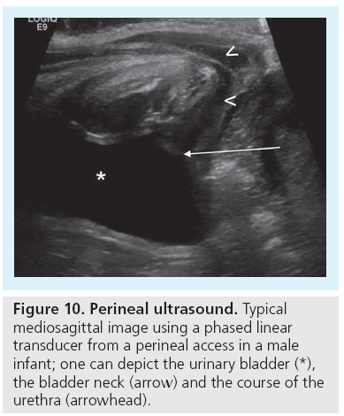 imaging-in-medicine-phased-linear