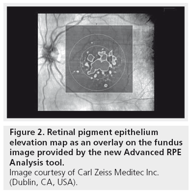 imaging-in-medicine-pigment-epithelium