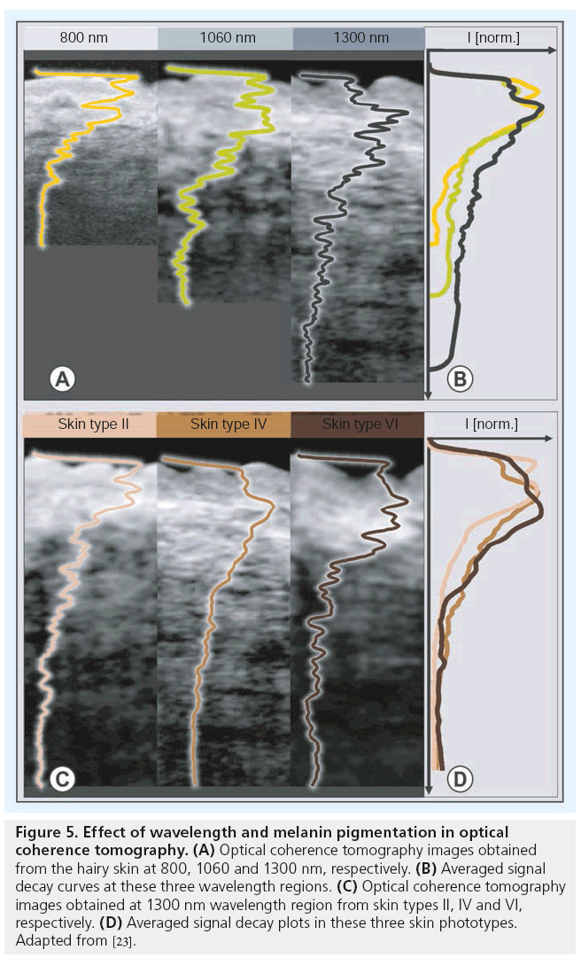 imaging-in-medicine-pigmentation