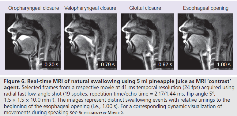 imaging-in-medicine-pineapple-juice