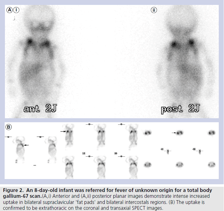 imaging-in-medicine-planar-images