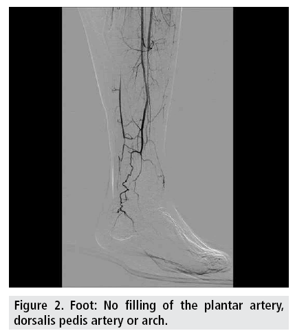imaging-in-medicine-plantar-artery