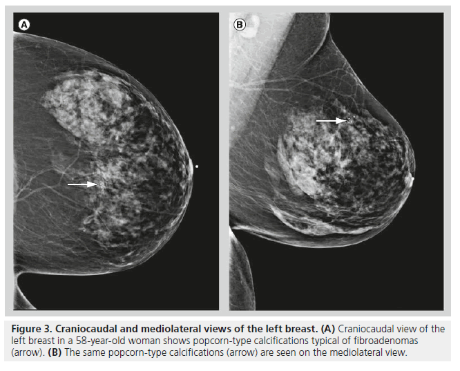 imaging-in-medicine-popcorn-type