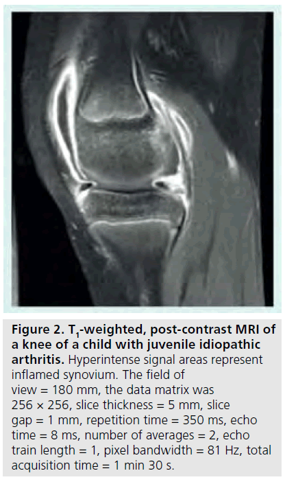 imaging-in-medicine-post-contrast