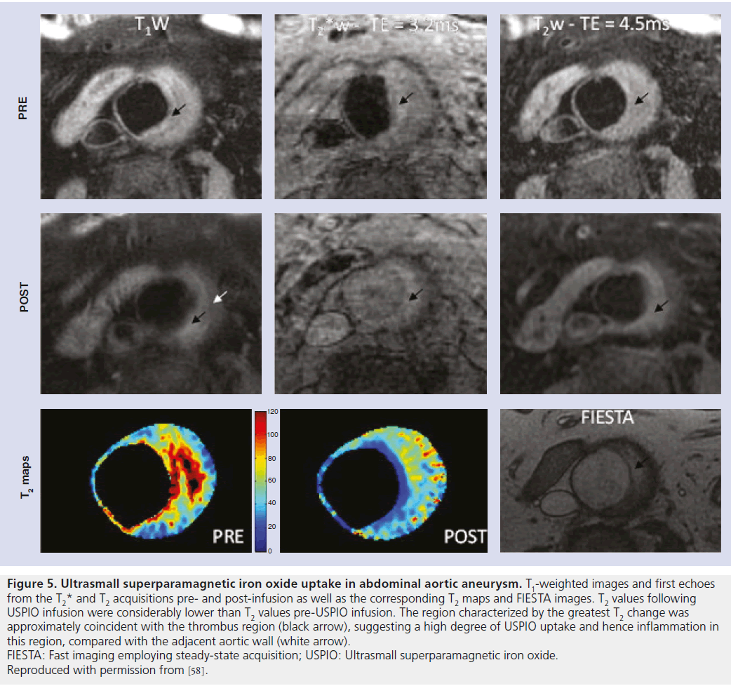 imaging-in-medicine-post-infusion