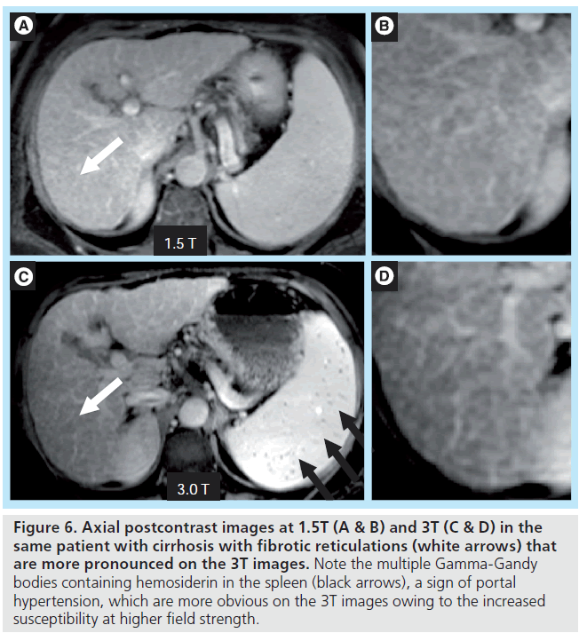 imaging-in-medicine-postcontrast-images