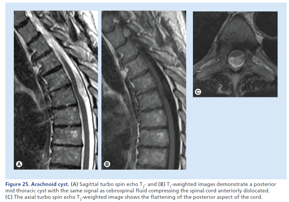 imaging-in-medicine-posterior-aspect